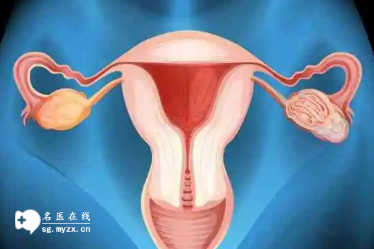 涪陵在哪做代孕好,国外第三代试管婴儿生男孩需要多少钱？筛查需要多少钱？